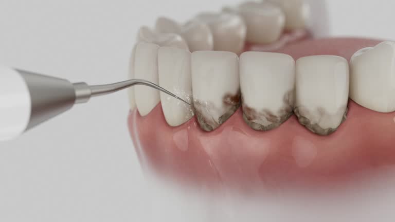 Trusted Teeth Whitening service in Seat Pleasant, MD - Dentist Open Now
